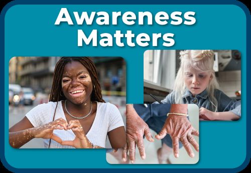 Vitiligo, Albinism, and Scleroderma Awareness
